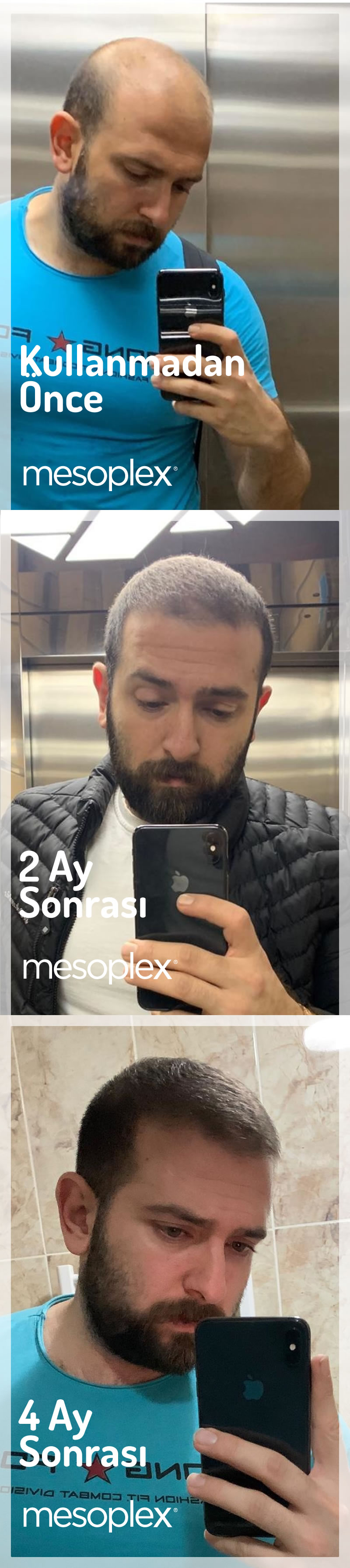 Mesoplex Resmi Satış Sitesi