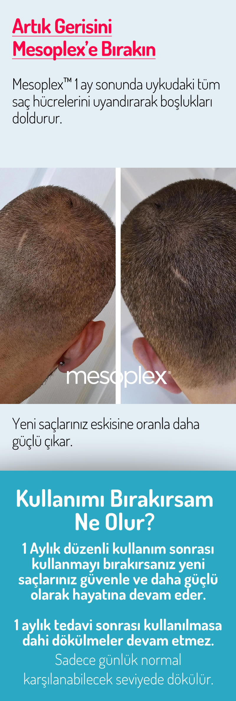 Mesoplex Resmi Satış Sitesi